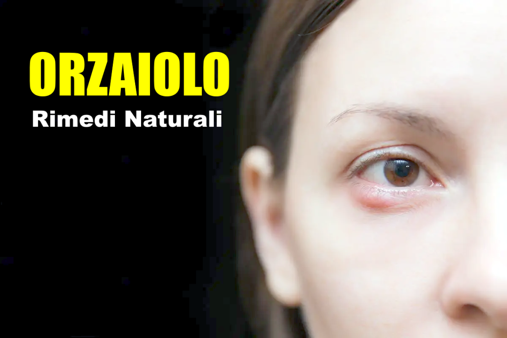 orzaiolo rimedi naturali efficaci