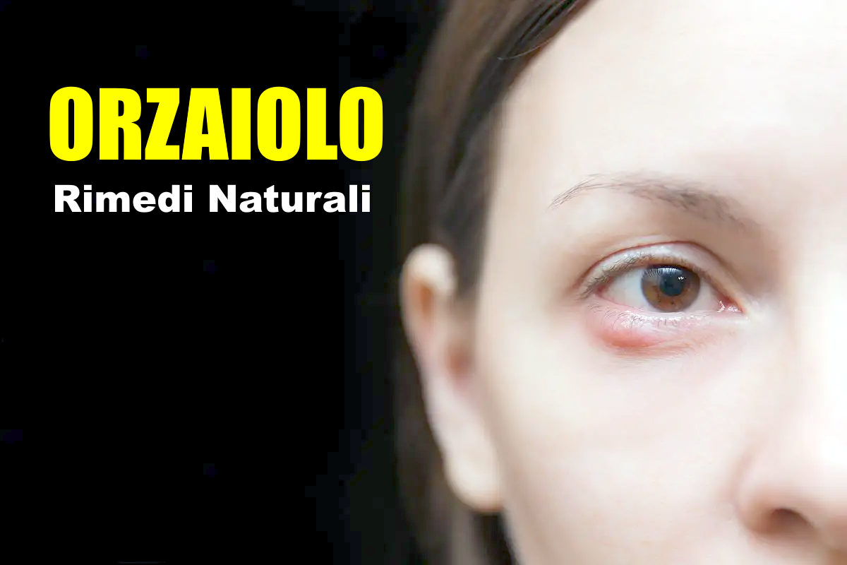 orzaiolo rimedi naturali efficaci